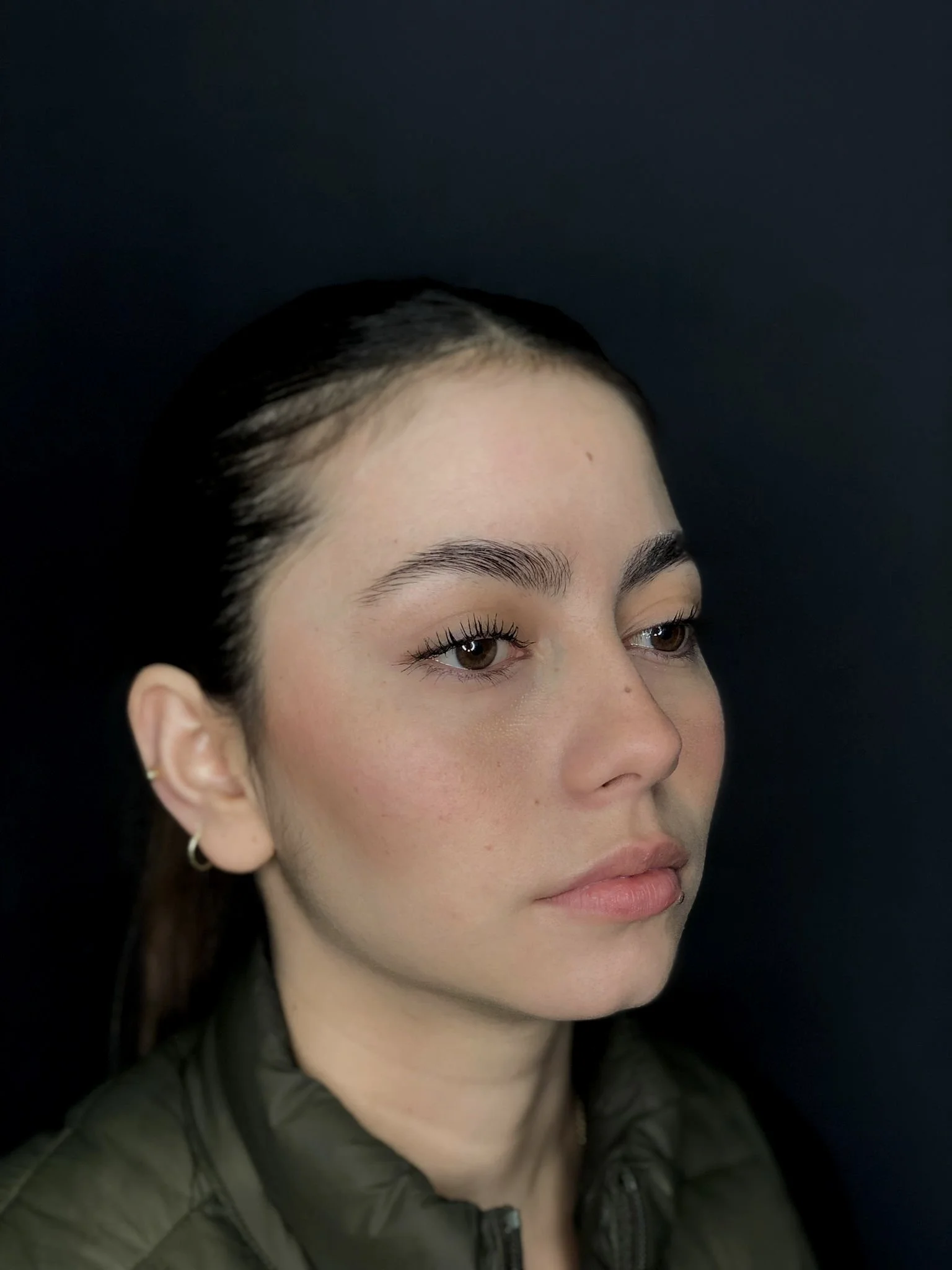 Eyelid Surgery
