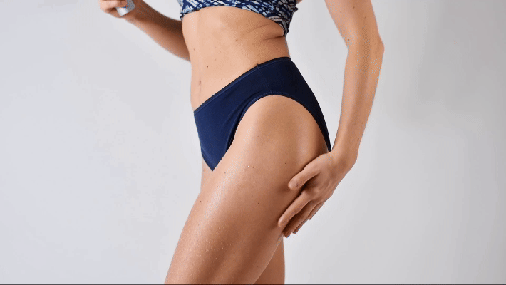 Thigh Lift — Thigh contouring — before & after