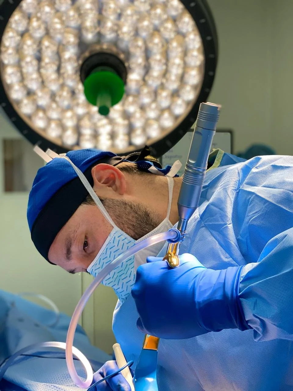 Liposuction