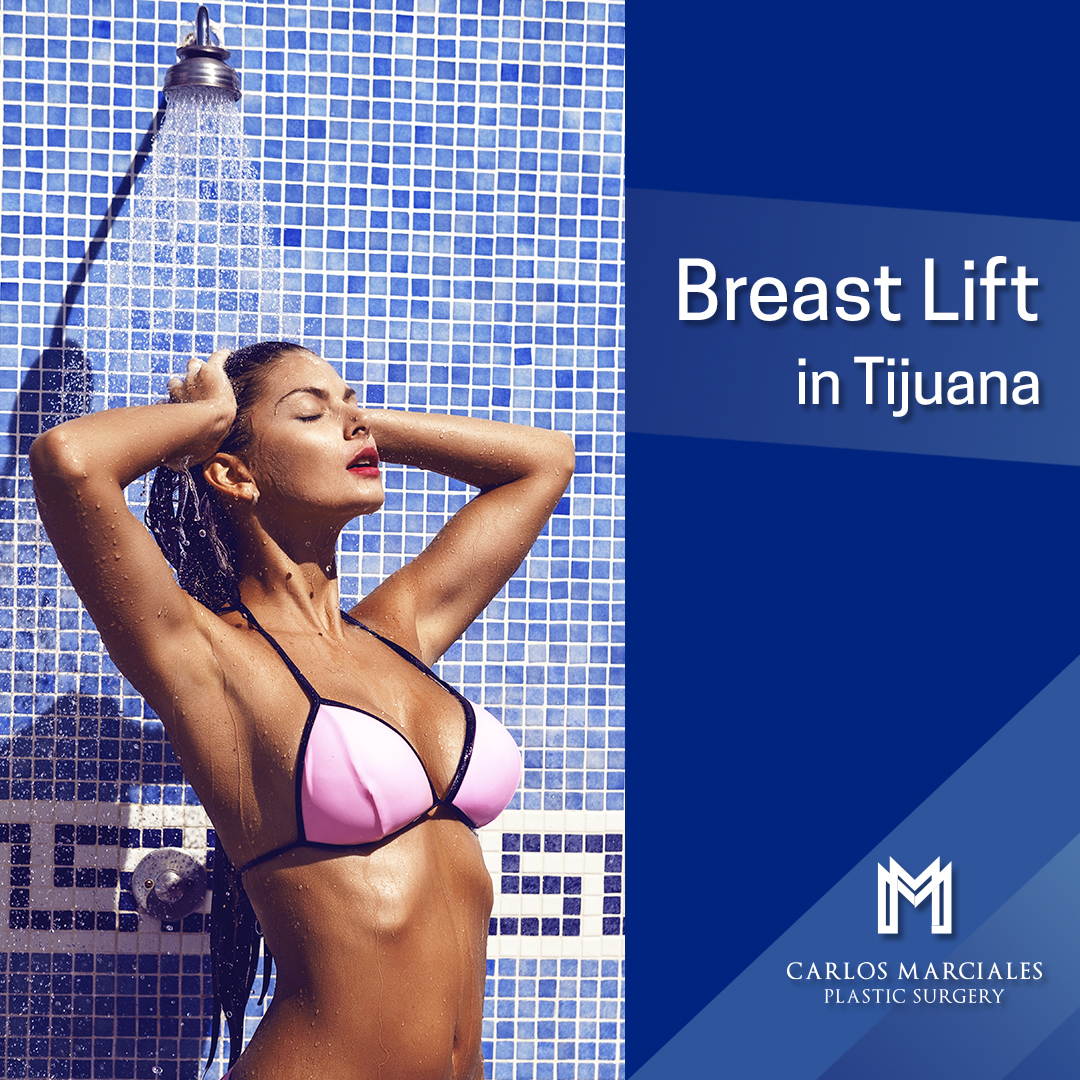 Breast lift in Tijuana